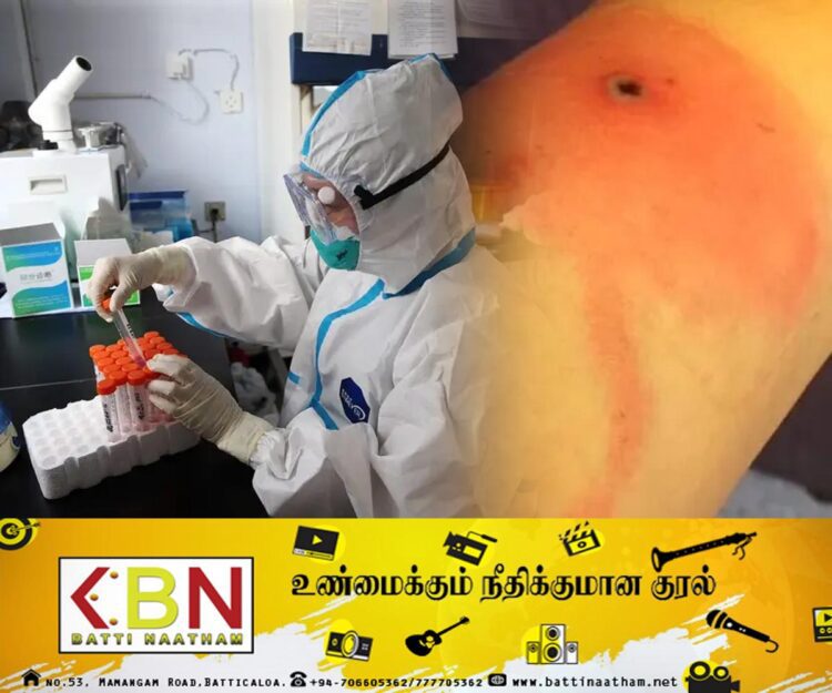 அமெரிக்காவில் கண்டறியப்பட்ட புதிய வகை வைரஸினால் ஒருவர் உயிரிழப்பு!