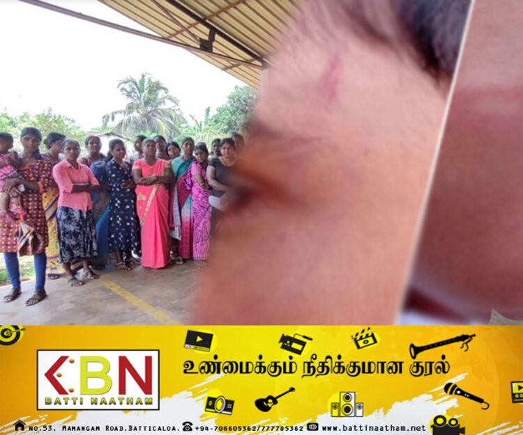 2ஆம் தர மாணவனை ஆசிரியர் தாக்கிய விவகாரம் ; மேலும் ஒரு குற்றச்சாட்டை முன் வைக்கும் ஊர் மக்கள்!