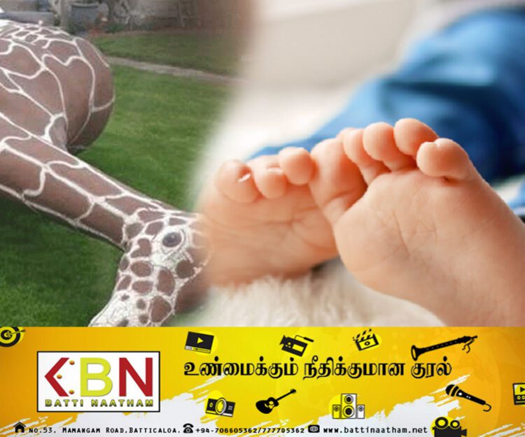 கொங்கிறீட்டிலான ஒட்டகச்சிவிங்கி சிலை வீழ்ந்ததில் சிறுவன் பலி!