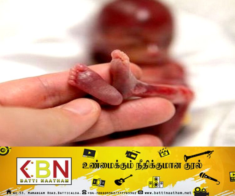 வெளிநாடுகளில் கருக்கலைப்பில் ஈடுபடும் இலங்கை மாணவர்கள்!