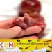 வெளிநாடுகளில் கருக்கலைப்பில் ஈடுபடும் இலங்கை மாணவர்கள்!