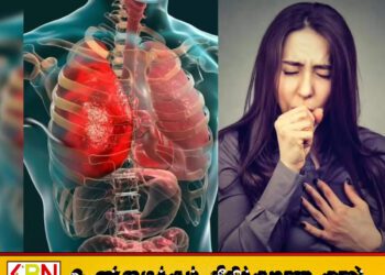 காசநோயினால் 1.23 மில்லியன் மக்கள் உயிரிழப்பு – உலக சுகாதார அமைப்பு