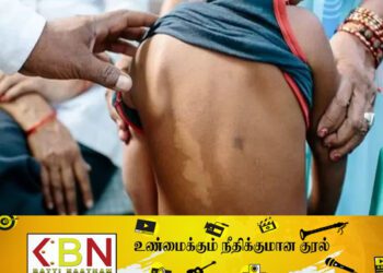 அறிகுறிகள் தென்பட்டால் உடன் வைத்தியரை நாடவும்!