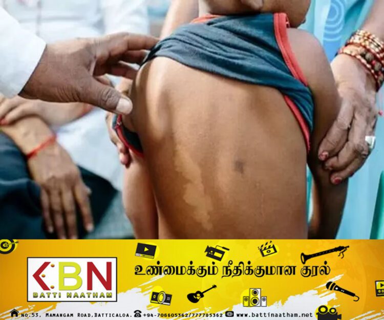 அறிகுறிகள் தென்பட்டால் உடன் வைத்தியரை நாடவும்!