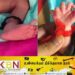 26 விரல்களுடன் பிறந்த குழந்தை!