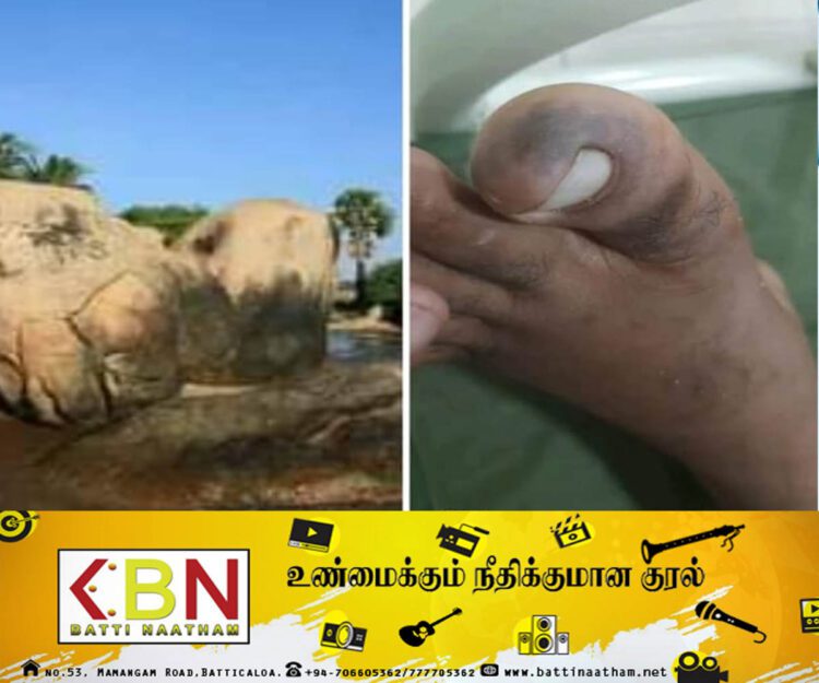 பாசிக்குடா கடற்கரை பகுதியில் விஷப் பூச்சிகள்; முகநூலில் பரவிவரும் பதிவு!