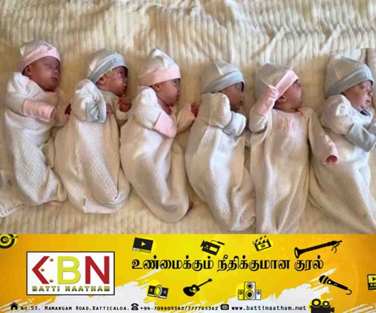ராகமயைச் சேர்ந்த தாய் ஒருவர் ஆறு இரட்டைக் குழந்தைகளை பிரசவிப்பு!