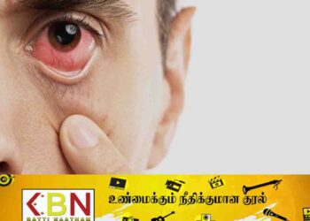 தற்போது பரவும் கண் நோயை தவிர்ப்பது குறித்து மருத்துவ ஆலோசனை!