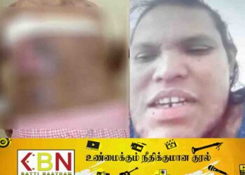 சவுதியில் இலங்கையை சேர்ந்த வீட்டுப் பணிப்பெண் ஒருவருக்கு தீ வைப்பு!