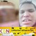 சவுதியில் இலங்கையை சேர்ந்த வீட்டுப் பணிப்பெண் ஒருவருக்கு தீ வைப்பு!