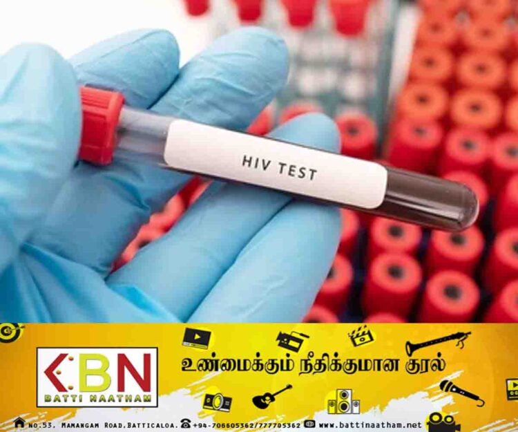 நாட்டில் எச்.ஐ.வி. தொற்றாளர்களின் எண்ணிக்கை சடுதியாக அதிகரிப்பு!