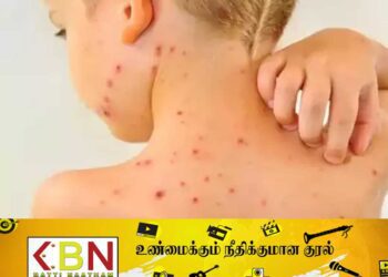 9 மாவட்டங்களிலும் நோயாளர்களின் எண்ணிக்கை அதிகரிப்பு!