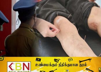 அக்குபஞ்சர் போலி வைத்தியரால் யாழில் ஒருவர் உயிரிழப்பு!
