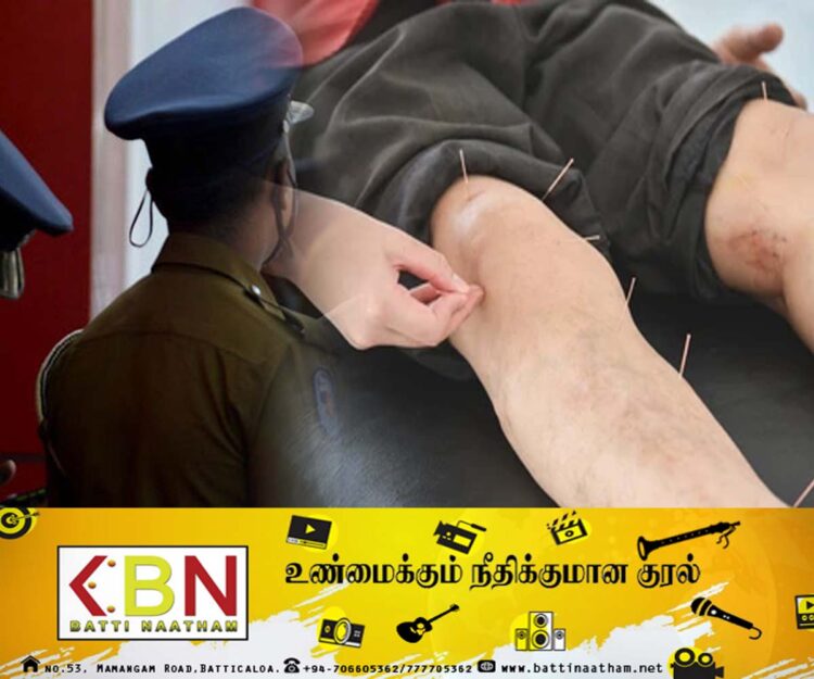 அக்குபஞ்சர் போலி வைத்தியரால் யாழில் ஒருவர் உயிரிழப்பு!