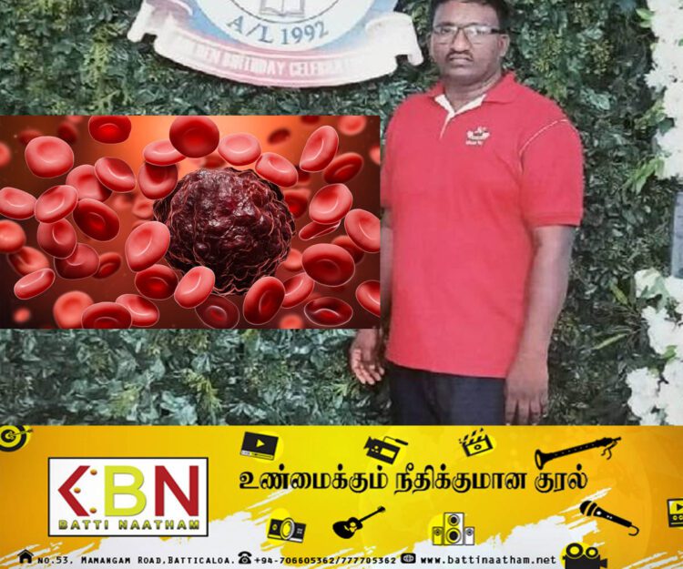 யாழில் இரத்தப்புற்று நோயினால் ஒருவர் பலி!