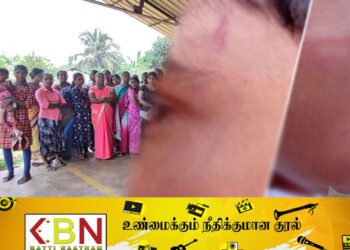 2ஆம் தர மாணவனை ஆசிரியர் தாக்கிய விவகாரம் ; மேலும் ஒரு குற்றச்சாட்டை முன் வைக்கும் ஊர் மக்கள்!