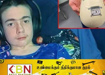 உலகில் முதன்முறையாக சிறுவனுக்கு பொருத்தப்பட்ட மூளையைக் கட்டுப்படுத்தும் மைக்ரோ!