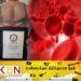 உடலில் பச்சை குத்திக்கொள்வோருக்கு இரத்தப்புற்றுநோய் ஏற்படும் அபாயம்!