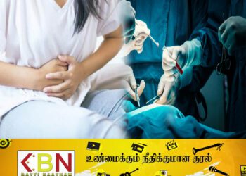 பெண்ணின் கருப்பையிலிருந்து 15 கிலோகிராம் கட்டி வெற்றிகரமாக அகற்றல்!