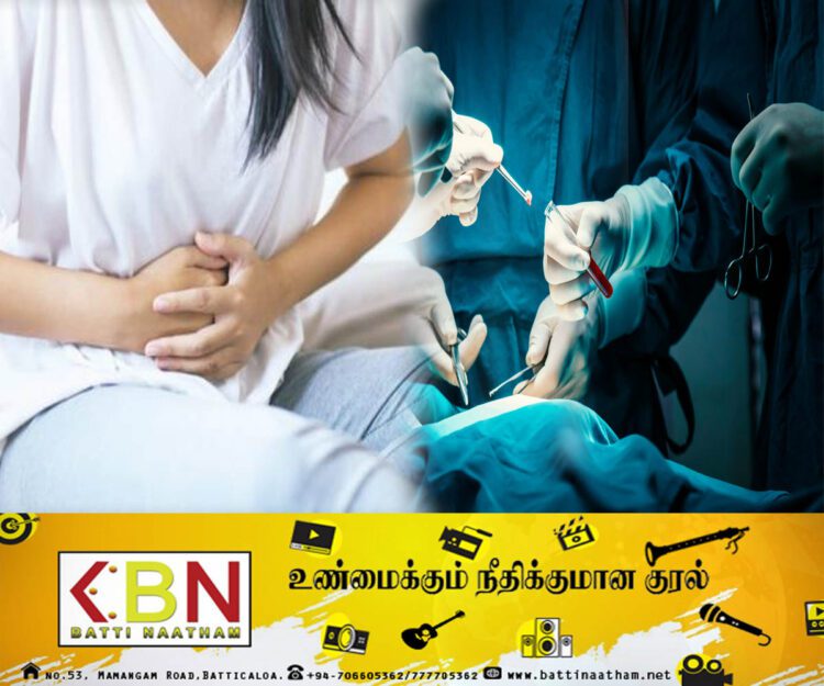 பெண்ணின் கருப்பையிலிருந்து 15 கிலோகிராம் கட்டி வெற்றிகரமாக அகற்றல்!