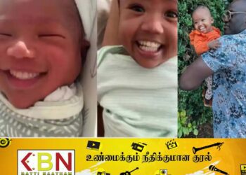 32 பற்களுடனும் பிறந்த குழந்தை!