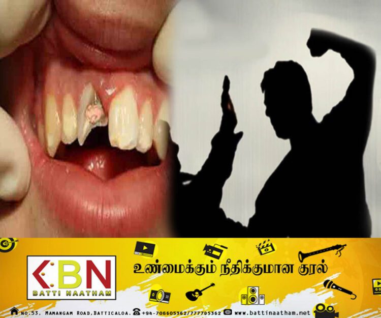 வீட்டுப் பாடம் எழுதாத மாணவனின் பல்லை உடைத்த ஆசிரியர்!