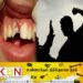 வீட்டுப் பாடம் எழுதாத மாணவனின் பல்லை உடைத்த ஆசிரியர்!