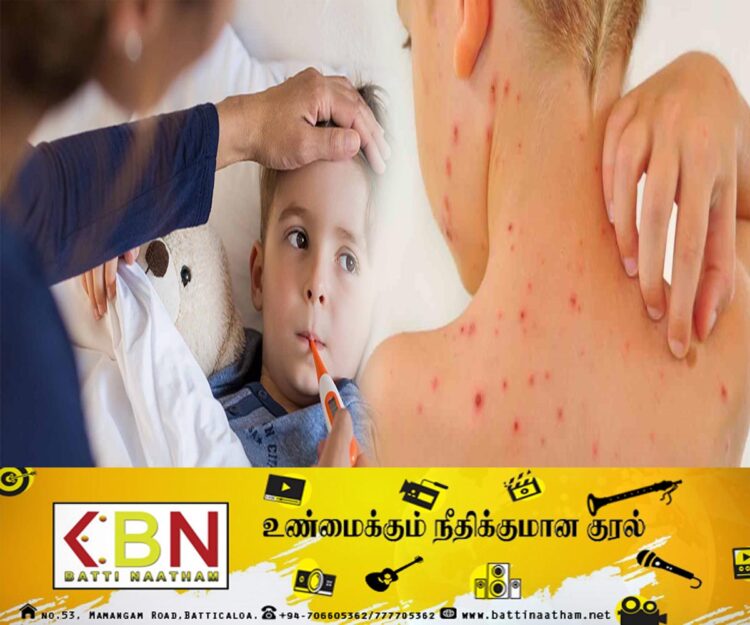 இந்தியாவில் குழந்தைகளை தாக்கும் சன்டிபுரா வைரஸ்; 15 பேர் உயிரிழப்பு!