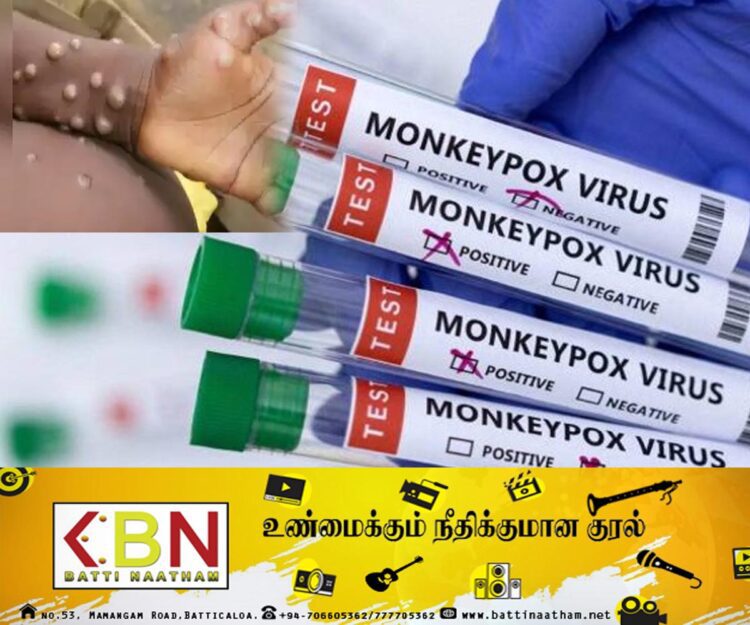 சுவீடனில் முதல் குரங்கம்மை நோயாளி அடையாளம்!