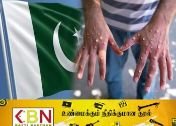 பாகிஸ்தானில் மூன்று குரங்கம்மை நோயாளிகள் அடையாளம்!