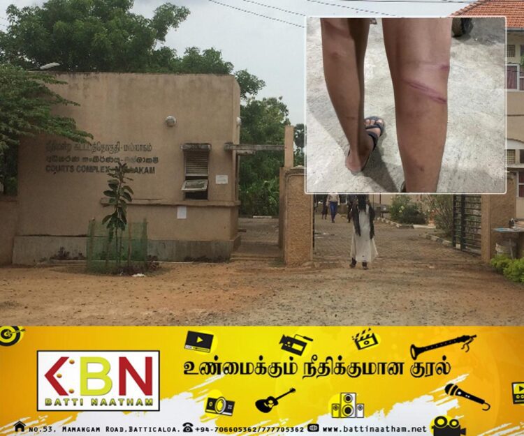 யாழில் மாணவன் மீது காட்டுமிராண்டித்தனமாக தாக்கிய ஆசிரியர்!
