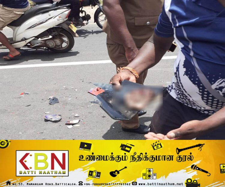 யாழில் கோர விபத்து; இளைஞனின் பாதம் துண்டிப்பு！