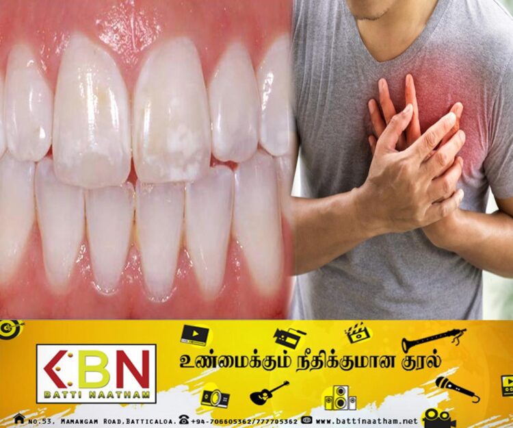 ஒரே நாளில் பிடுங்கப்பட்ட 23 பற்கள்; நபர் மாரடைப்பால் உயிரிழப்பு!
