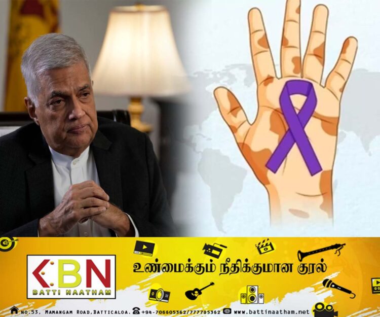 வடக்கு, கிழக்கில் தொழுநோய் பாதிப்பு; ஜனாதிபதி வெளியிட்டுள்ள ஊடக அறிக்கை!