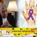 வடக்கு, கிழக்கில் தொழுநோய் பாதிப்பு; ஜனாதிபதி வெளியிட்டுள்ள ஊடக அறிக்கை!