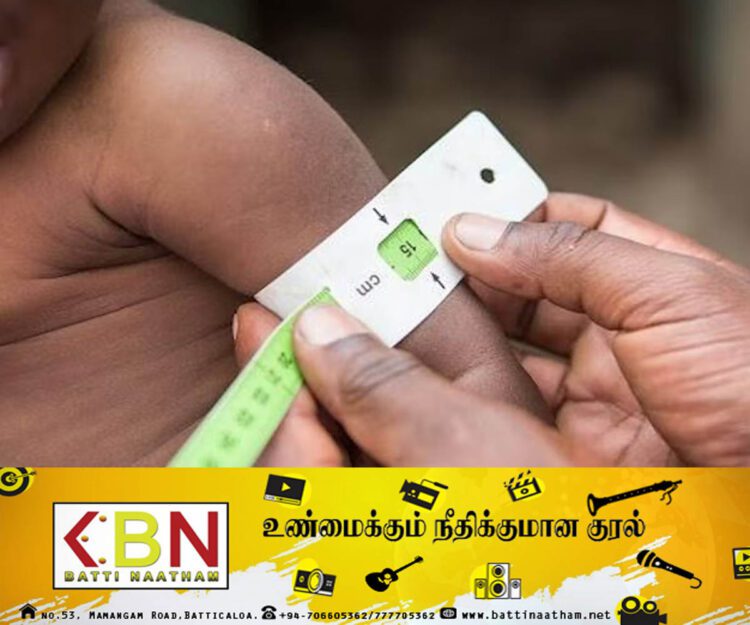 நாட்டில் 16000 க்கும் மேற்பட்ட குழந்தைகளுக்கு ஊட்டச்சத்து குறைபாடு！