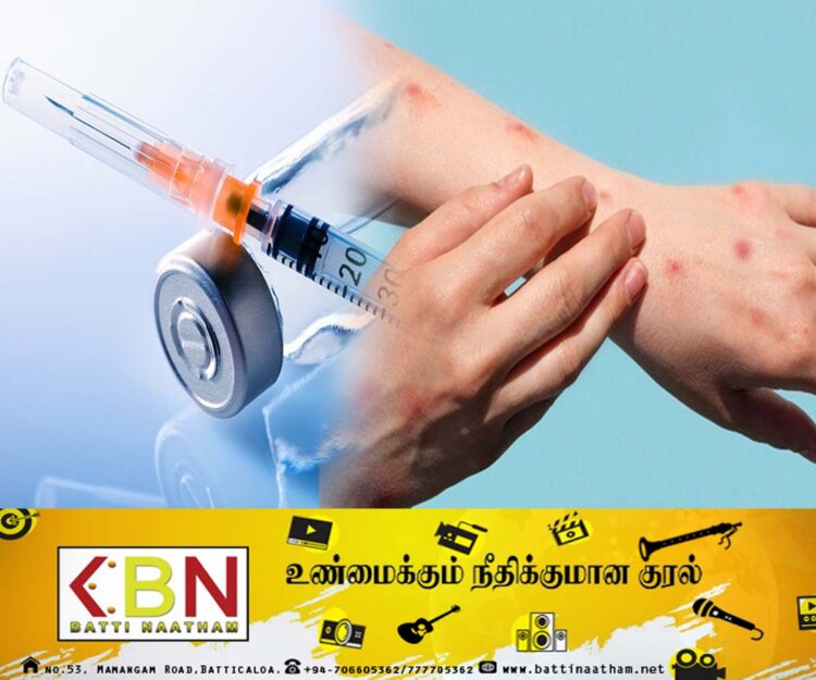 குரங்கம்மை நோய்க்கு எதிரான தடுப்பூசியை பயன்படுத்த உலக சுகாதார அமைப்பு அனுமதி!