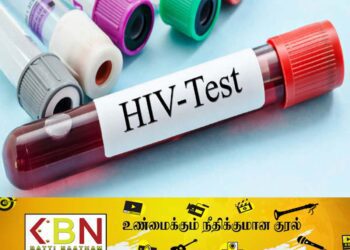 அம்பாந்தோட்டை மாவட்டத்தில் எயிட்ஸ் நோயாளர்களின் எண்ணிக்கை அதிகரிப்பு!