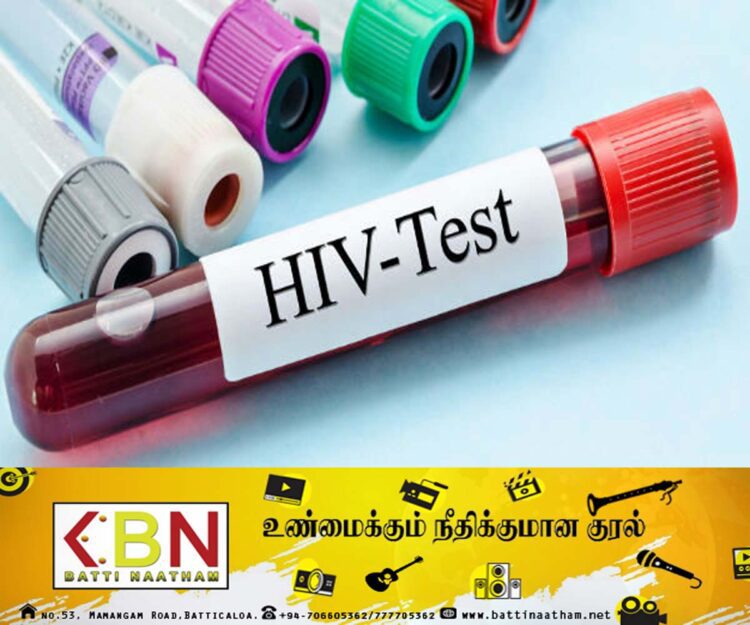 அம்பாந்தோட்டை மாவட்டத்தில் எயிட்ஸ் நோயாளர்களின் எண்ணிக்கை அதிகரிப்பு!