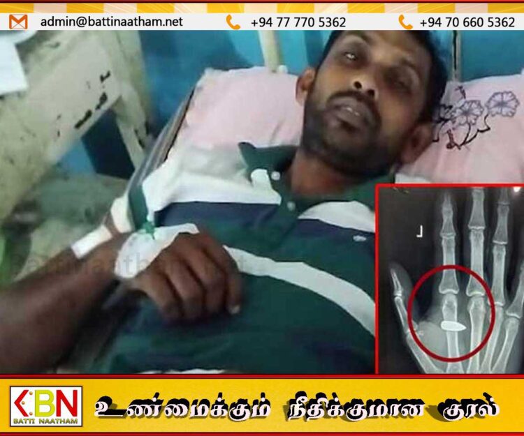 வயல்வெளியில் விவசாயம் செய்து கொண்டிருந்தவர் வைத்தியசாலையில் அனுமதி; கையினுள் இருந்த துப்பாக்கி தோட்டா