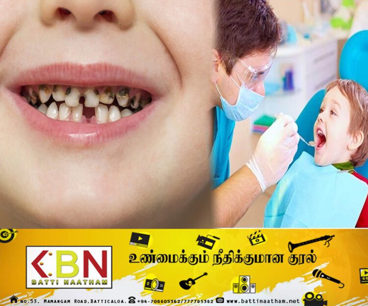 சிறுவர்களிடையே பல் நோய் அதிகரிப்பு!