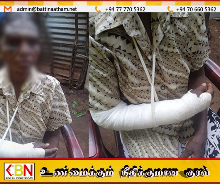 யாழ் இணுவில் பகுதியில் ஒரே குடும்பத்தை சேர்ந்த நால்வர் படுகாயம்