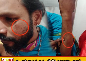 கிளிநொச்சியில் மதகுரு ஒருவர் மீது தாக்குதல்