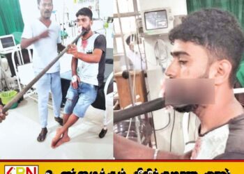 முரண்பாடு முற்றியதில் மகனின் வாயை கிழித்த தந்தை