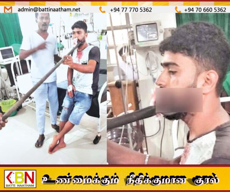 முரண்பாடு முற்றியதில் மகனின் வாயை கிழித்த தந்தை