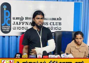 வயர் வெட்டி களவாடியதாக குற்றம்சாட்டி இளைஞனின் கையை முறித்த நெல்லியடி பொலிஸார்