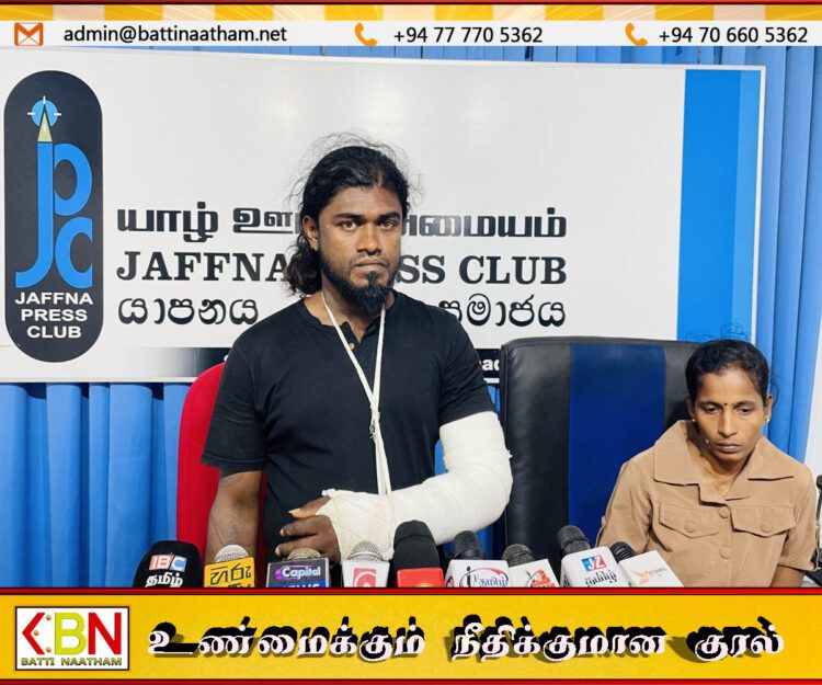 வயர் வெட்டி களவாடியதாக குற்றம்சாட்டி இளைஞனின் கையை முறித்த நெல்லியடி பொலிஸார்
