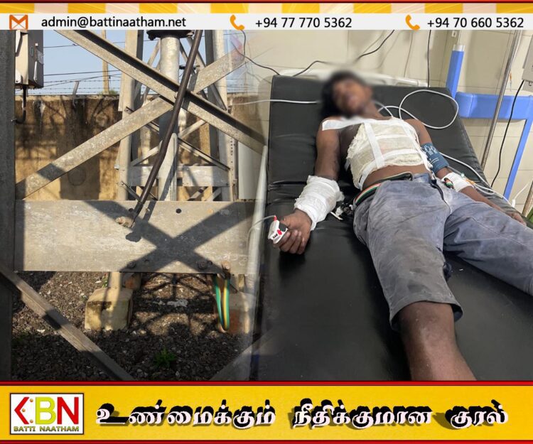 மின்சார கம்பிகளை வெட்டி திருட முயன்ற இளைஞன் மின்சாரம் தாக்கி படுகாயம்; மட்டக்களப்பில் சம்பவம்