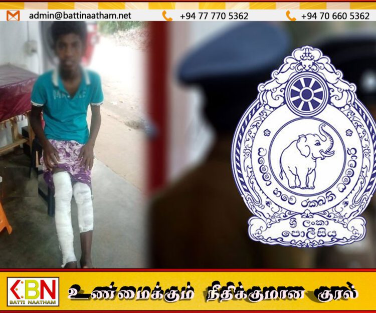 சிங்களப் பாடசாலையில் தமிழ் மாணவன் தீ வைத்து எரிப்பு; பாடசாலை நிர்வாகம் – பொலிஸ் என்ன செய்தது?
