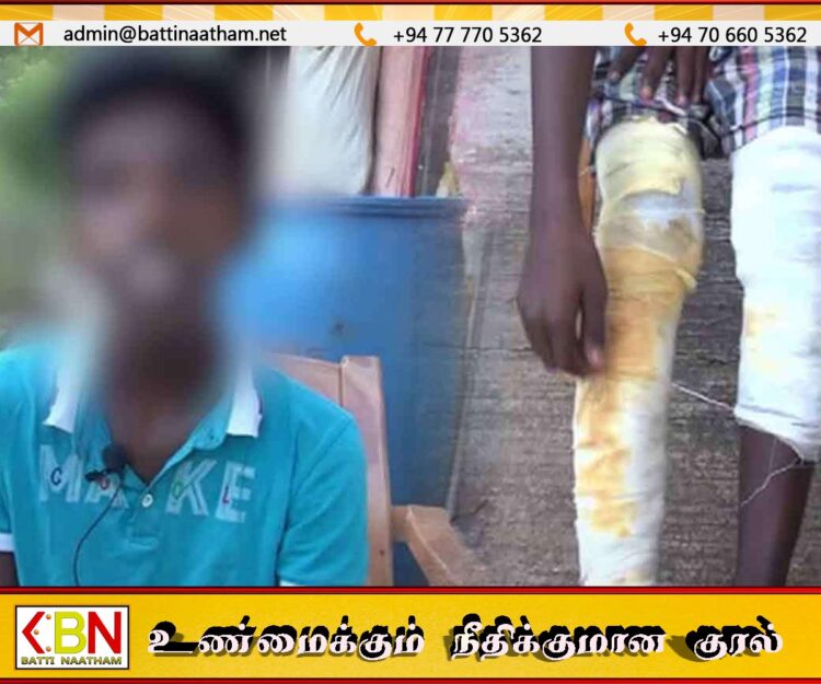 காட்டிக்கொடுத்ததால் பழிவாங்கும் நோக்கில் சக மாணவனை தின்னர் மூலம் பற்றவைத்த ஐந்தாம் தர மாணவர்கள்